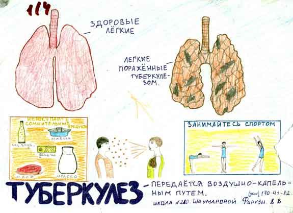 Католическая благотворительная организация борется с туберкулезом в тюрьмах Средней Азии