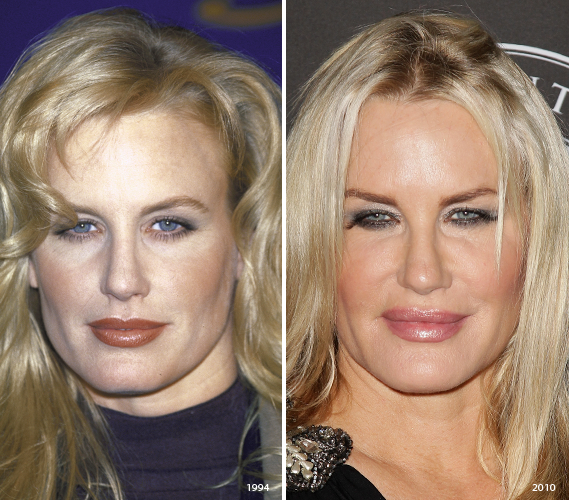 Celebrity nose mouth gap Celebrity nose mouth gap